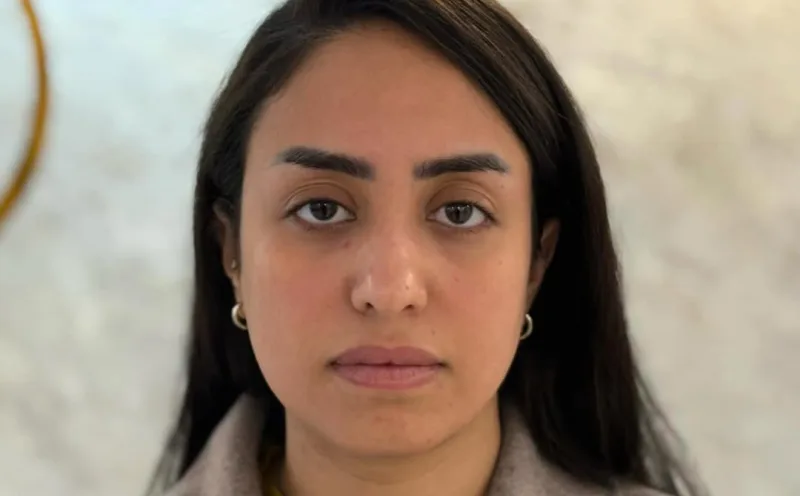 حقن الفيلر — قبل